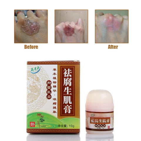 Skin healing ointment,wound  Cream Bedsores