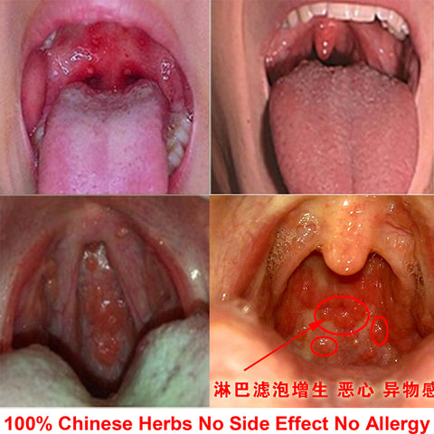 100% Organic Chinese Herbs Pastilles Sore